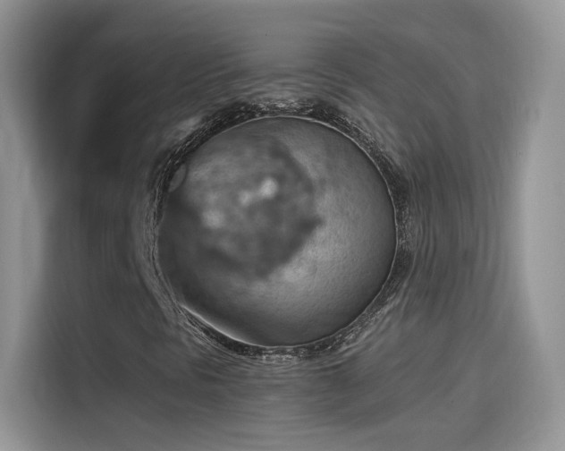 X0000115611297200911171140