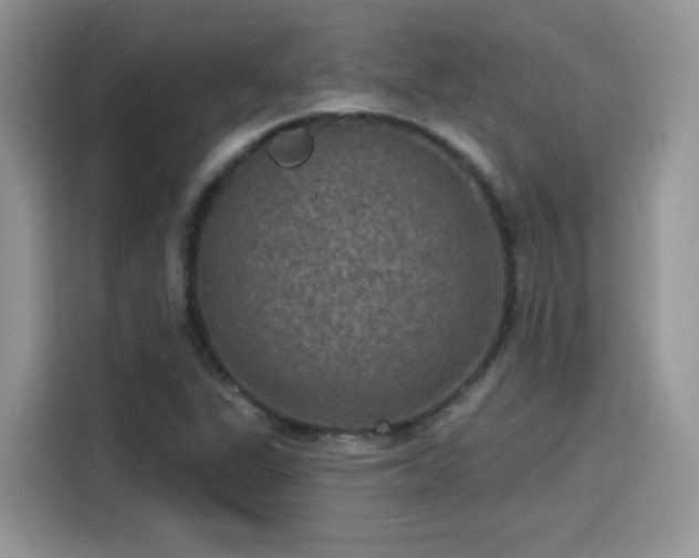 X0000115611311200911171140