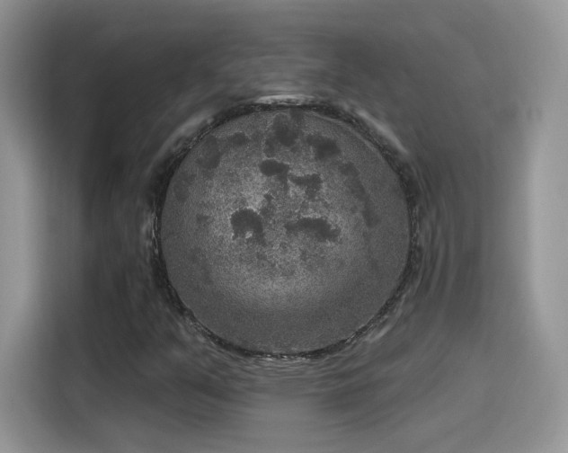 X0000115611351200911171140
