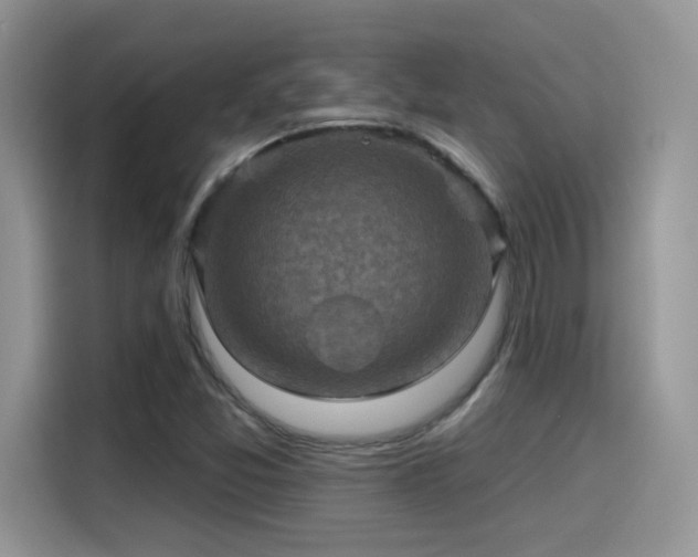 X0000115611357200911171140