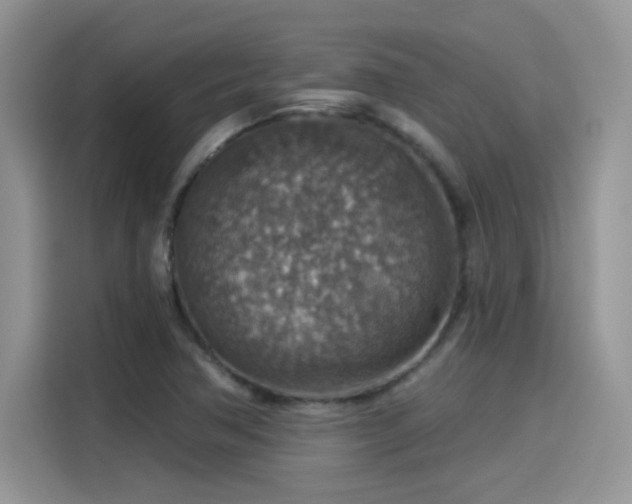 X0000115611362200911171140