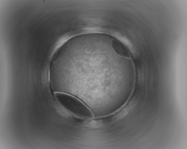 X0000115611365200911171140