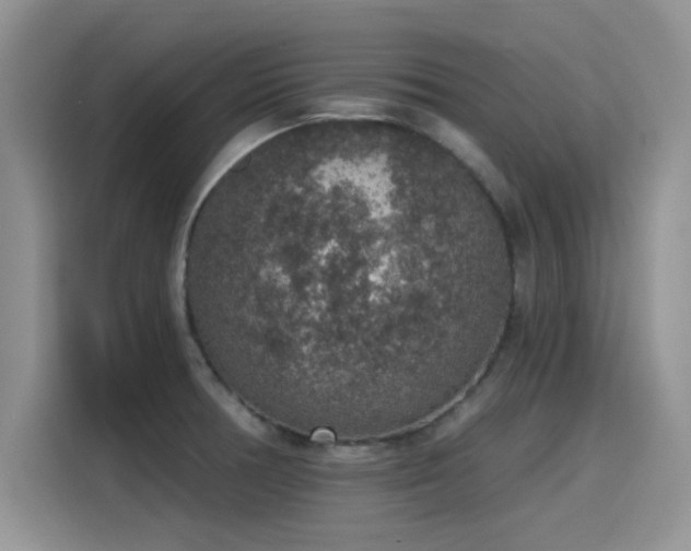 X0000115611378200911171139