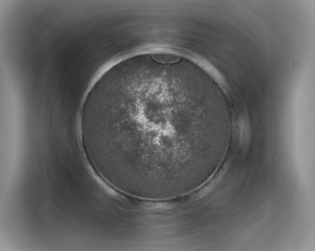X0000115611382200911171139