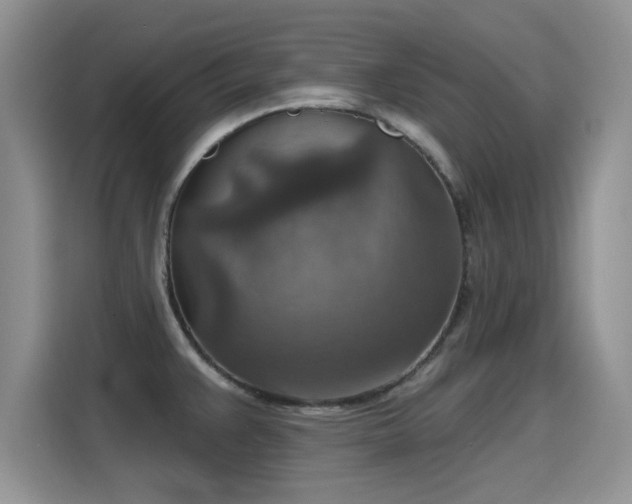 X0000115611383200911171139