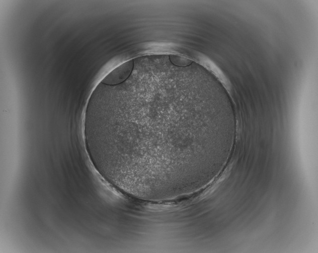 X0000115611386200911171139