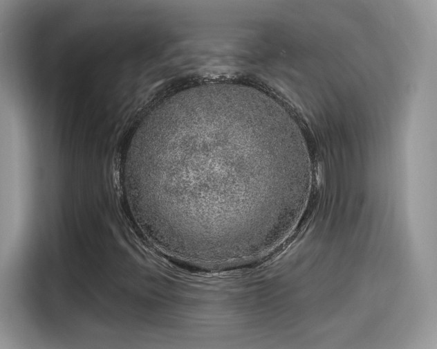 X0000115611396200911171139