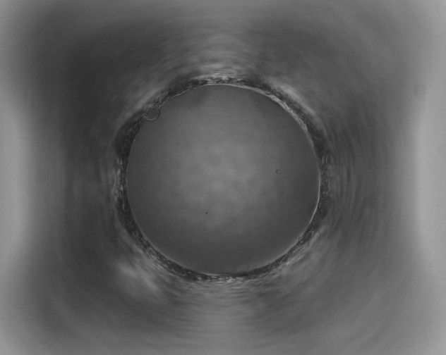 X0000115611399200911171139