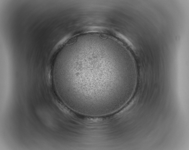 X0000115611403200911171139