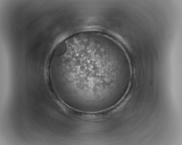 X0000115611405200911171139