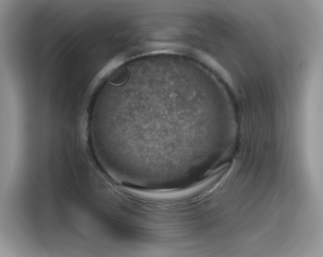 X0000115611411200911171139