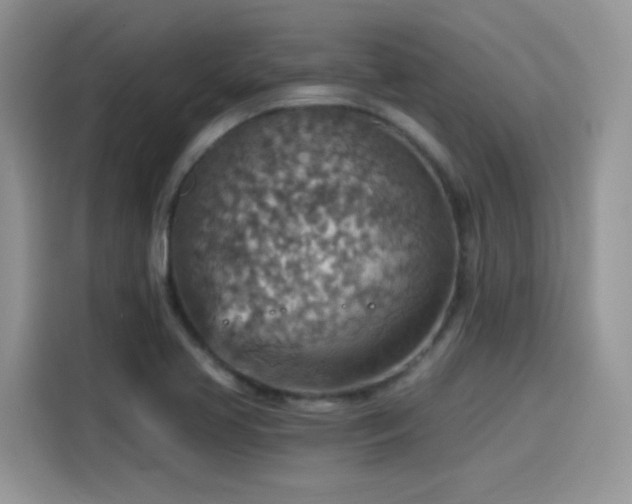 X0000115611413200911171139