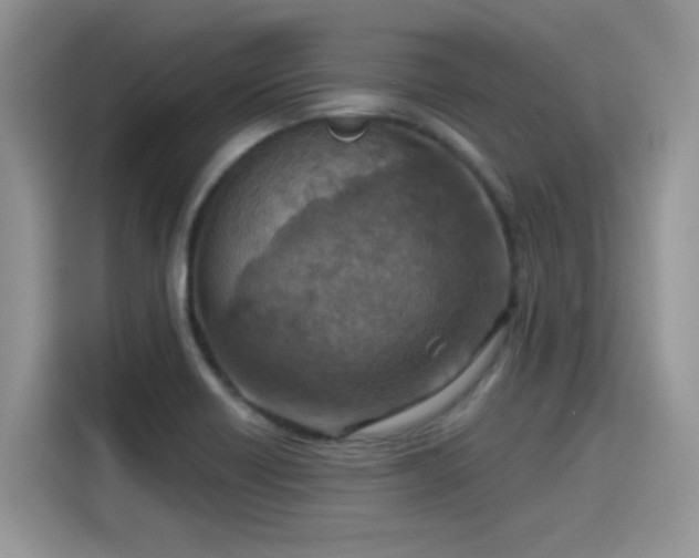 X0000115611418200911171139
