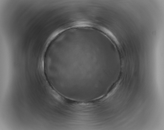 X0000115611419200911171139