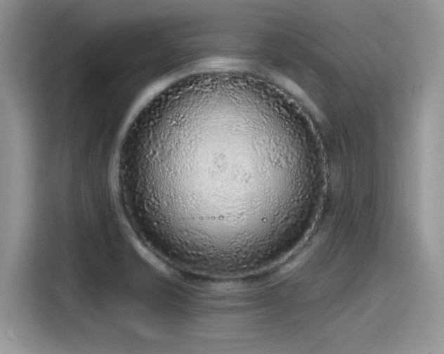 X0000115611421200911171139