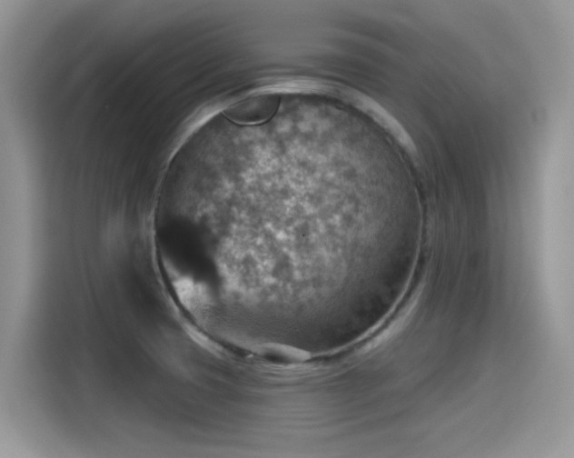 X0000115611425200911171139