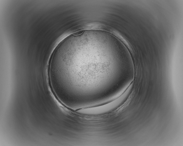 X0000115611434200911171139