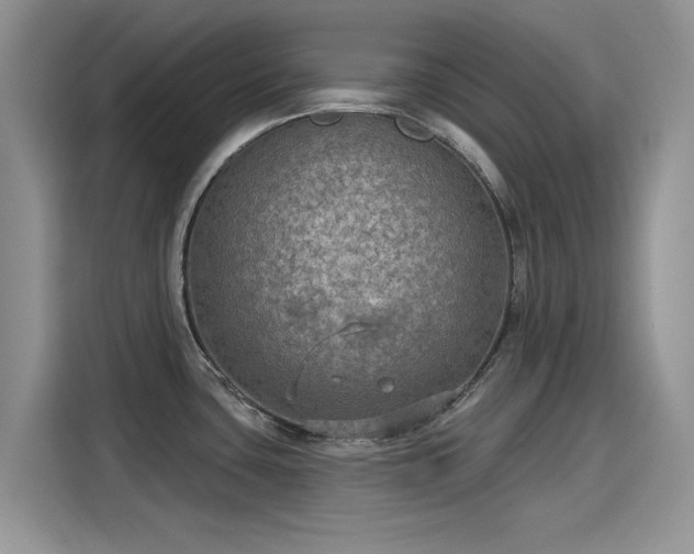X0000115611435200911171139