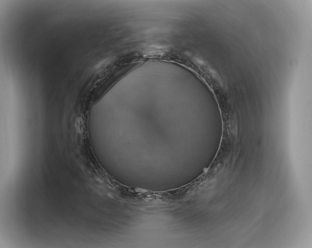 X0000115611445200911171139