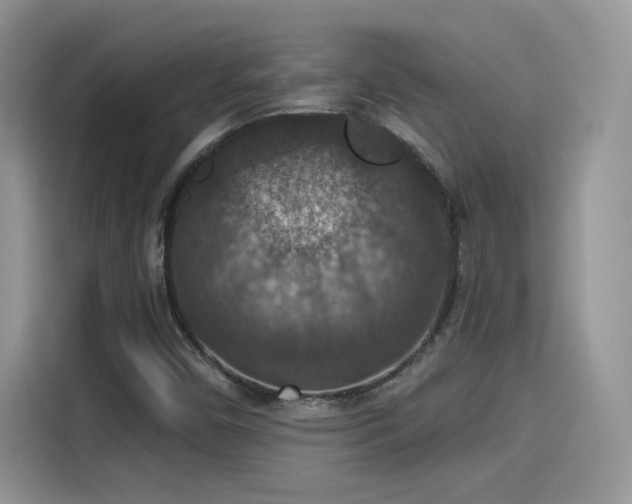 X0000115611450200911171139