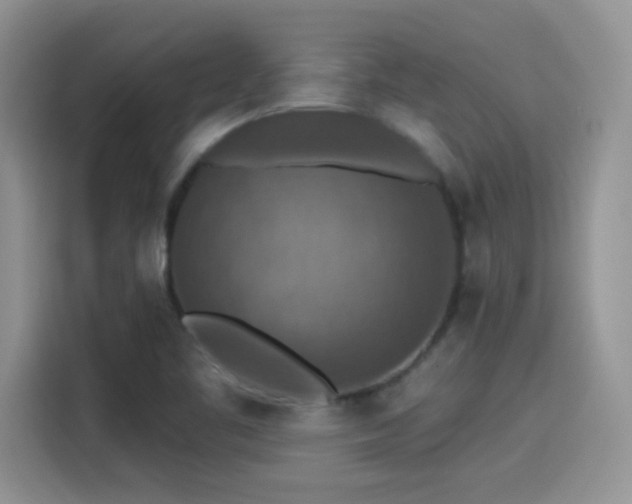 X0000115611461200911171138