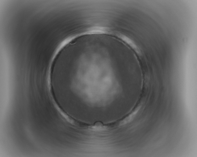 X0000115611469200911171138