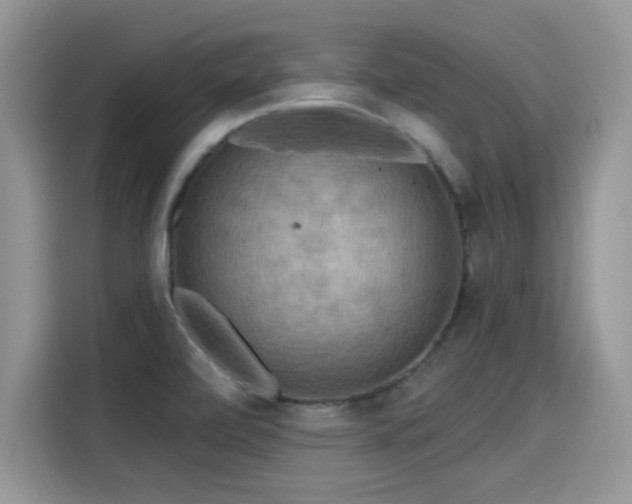 X0000115611472200911171138