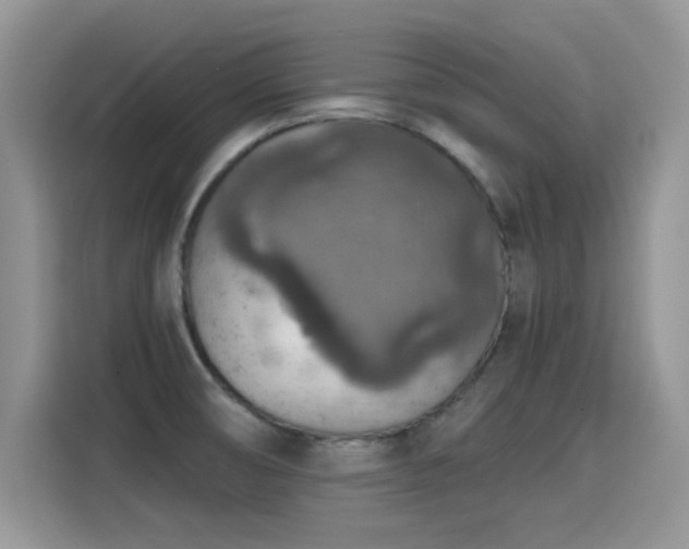 X0000115611474200911171138