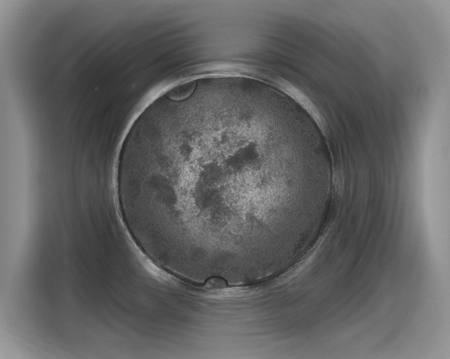 X0000115611482200911171138