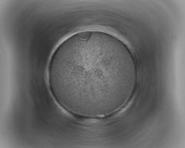 X0000115611517200911171138