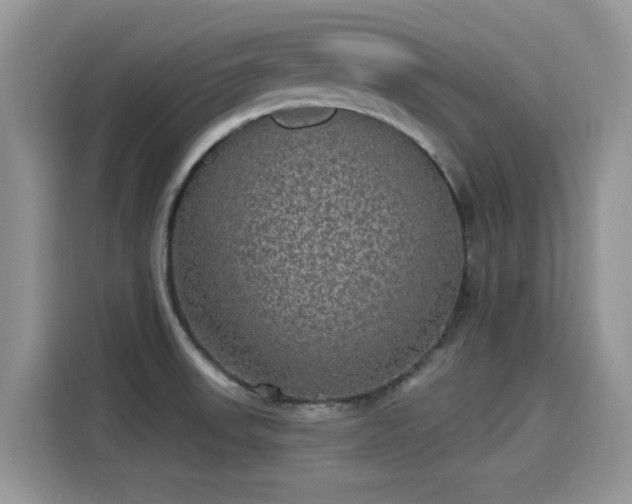 X0000115611523200911171138