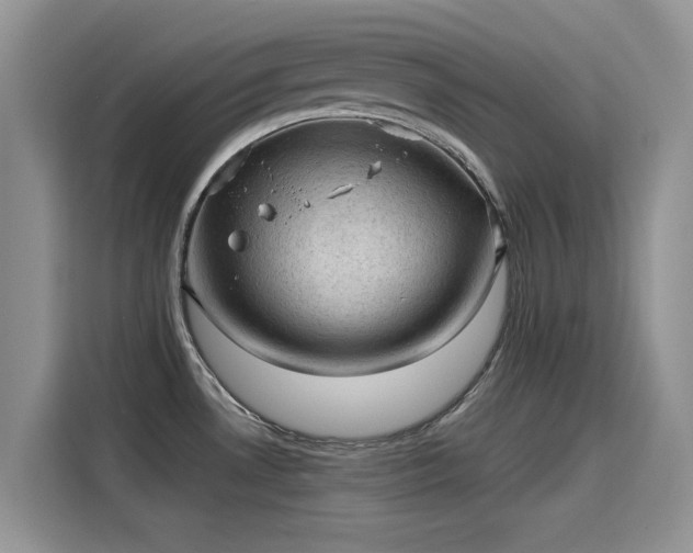 X0000115611530200911171138