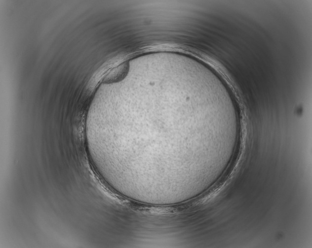 X0000115610857200912011549