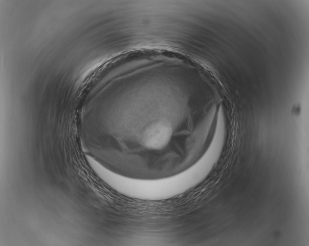 X0000115611064200912011545