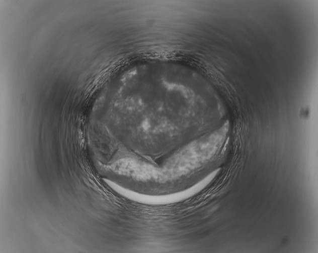 X0000115611202200912011542