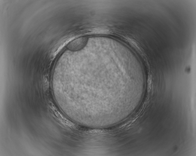 X0000115611212200912011542