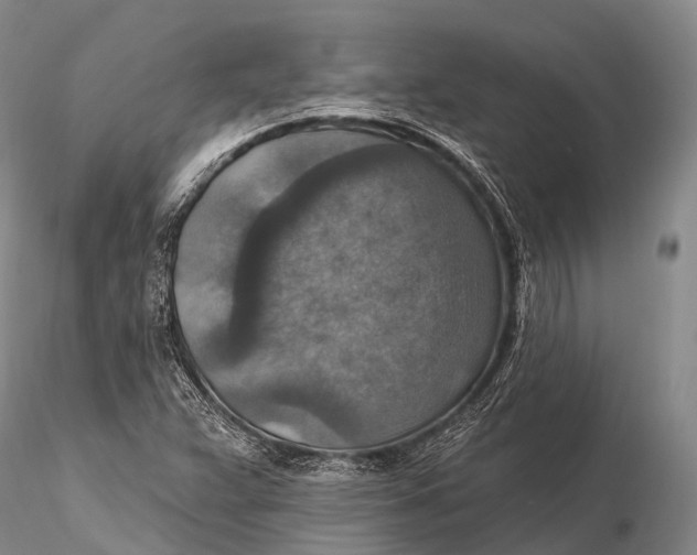 X0000115611359200912011541