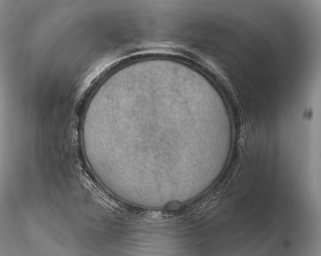 X0000115611360200912011541