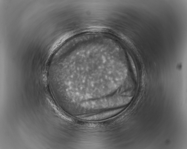 X0000115611362200912011541