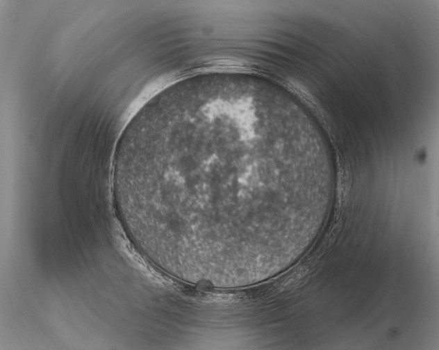 X0000115611378200912011540
