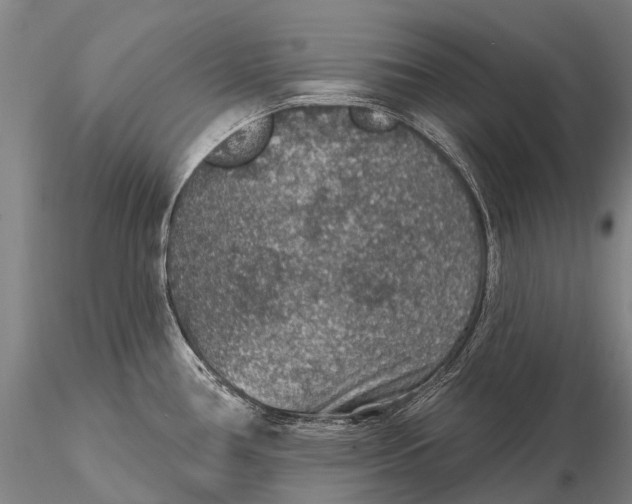 X0000115611386200912011540