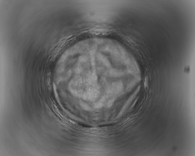 X0000115611396200912011539