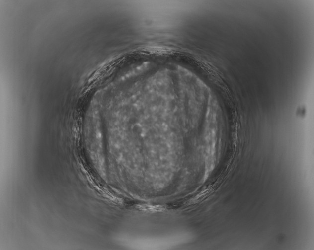 X0000115611397200912011539