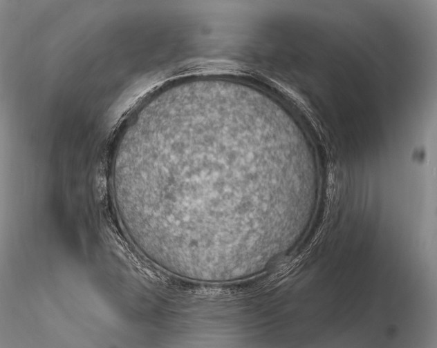 X0000115611407200912011539