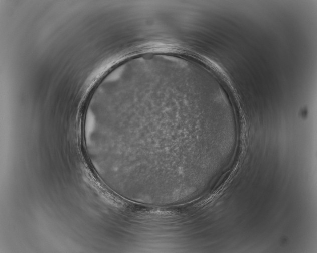 X0000115611419200912011540