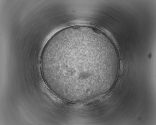 X0000115611435200912011540