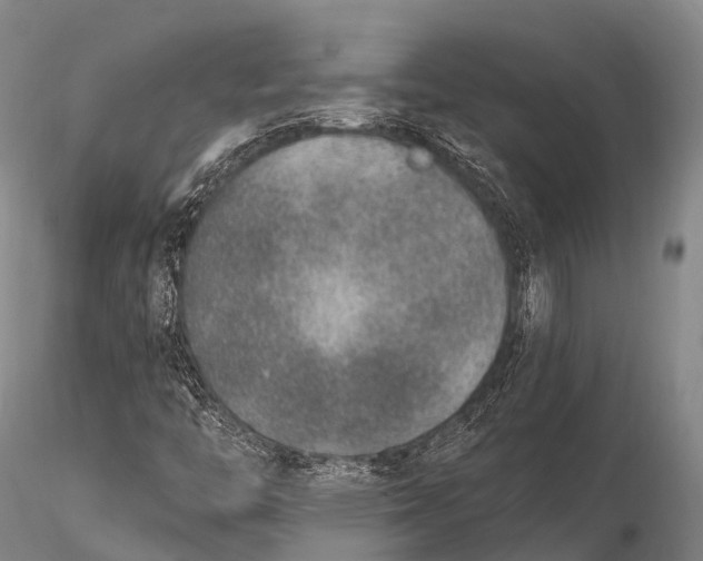 X0000115611446200912011539