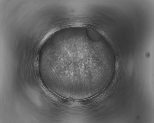 X0000115611450200912011539