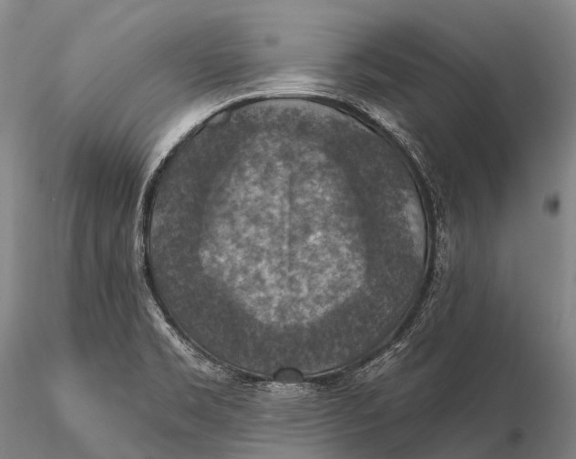 X0000115611469200912011539