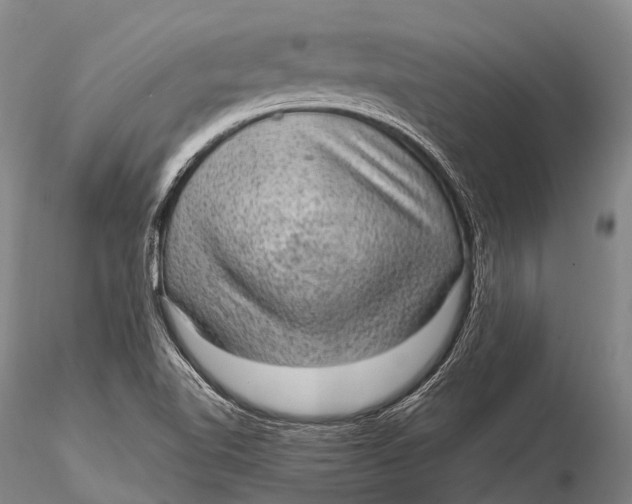 X0000115611510200912011538